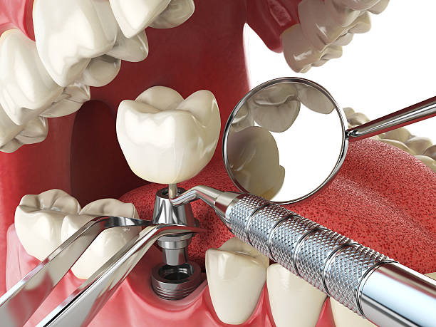 Best Emergency Orthodontic Repairs in Oneida, TN